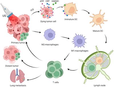 Immunogenic sonodynamic therapy for inducing immunogenic cell death and activating antitumor immunity